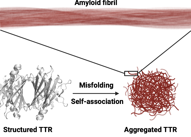 A Blood-Based Diagnostic Breakthrough for Transthyretin Amyloidosis
