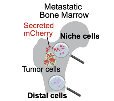 Tumor cells steal iron from macrophages to thrive during bone metastasis