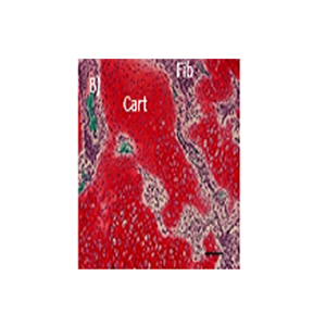 A timeseries analysis of the fracture callus extracellular matrix proteome during bone fracture healing